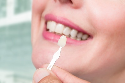 dentist checks veneer of tooth crown